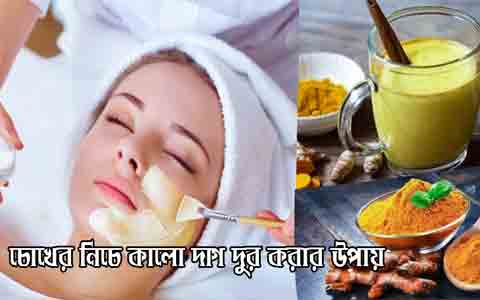 চোখের নিচে কালো দাগ দূর করার উপায়